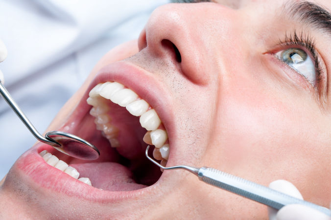 Periodoncia el escorial